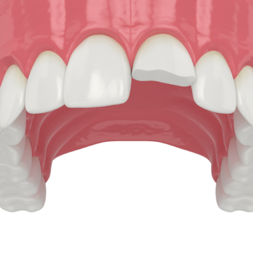 blog - Cheadle Hulme Dental