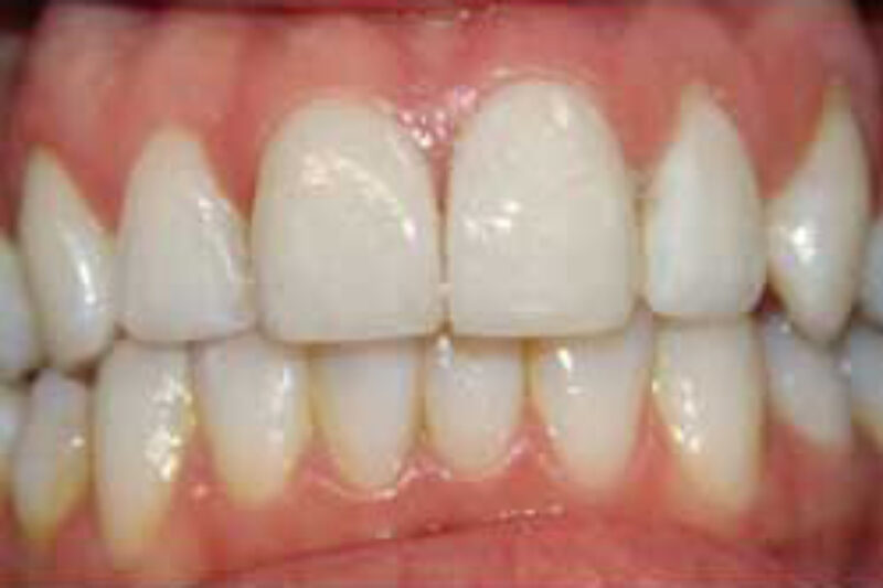 After - Cheadle Hulme Dental