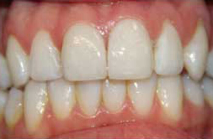 After - Cheadle Hulme Dental