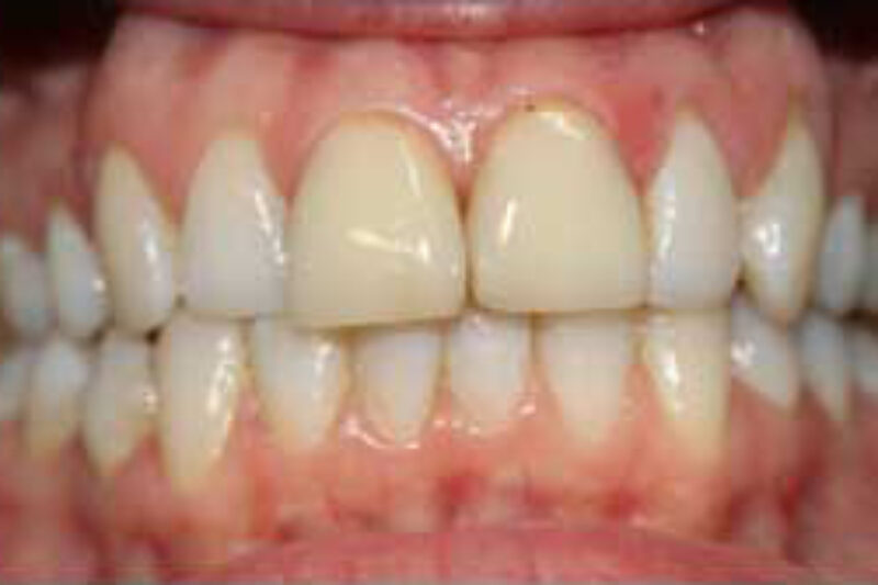 Before - Cheadle Hulme Dental