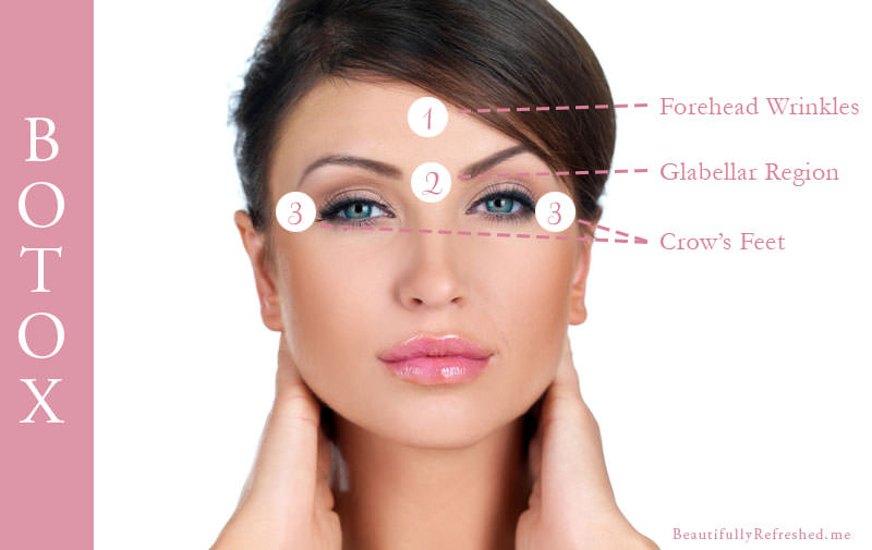 How Botox Works: Targeting Muscles to Soften Wrinkles | Cheadle Hulme ...