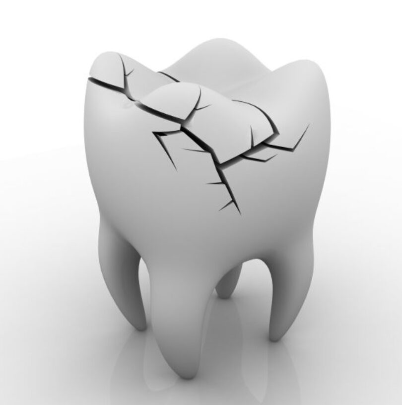 blog - Cheadle Hulme Dental