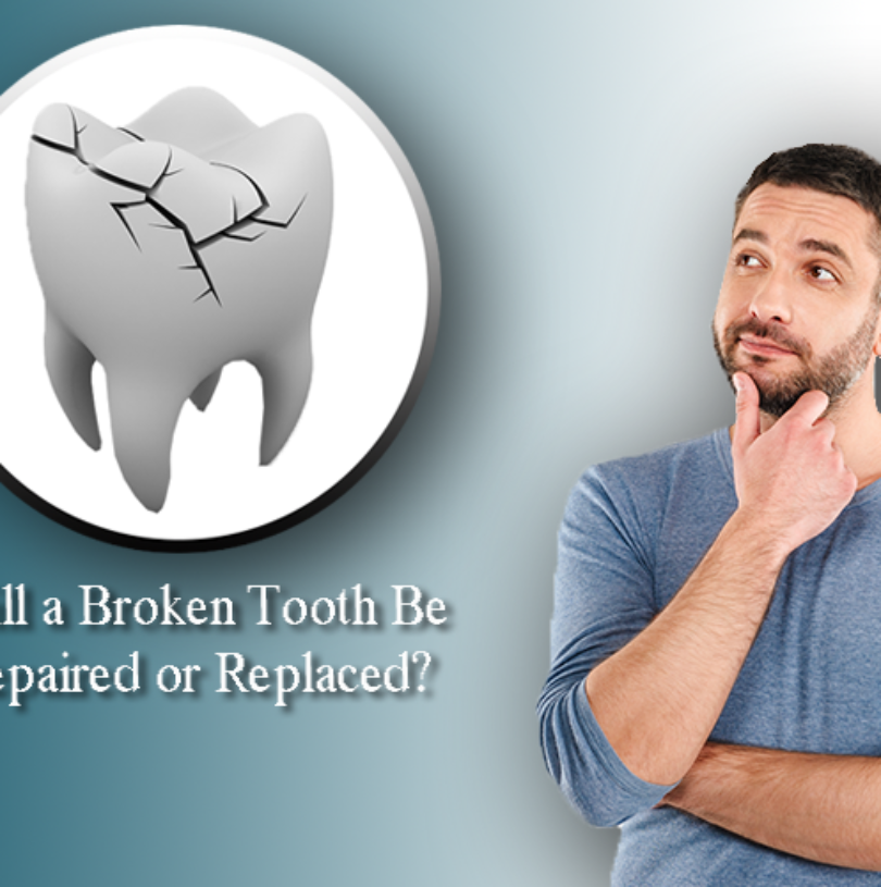 blog - Cheadle Hulme Dental