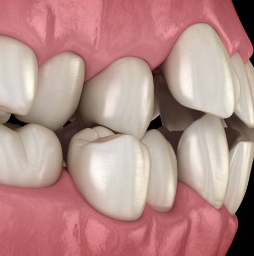 blog - Cheadle Hulme Dental