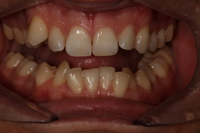 Before - Cheadle Hulme Dental