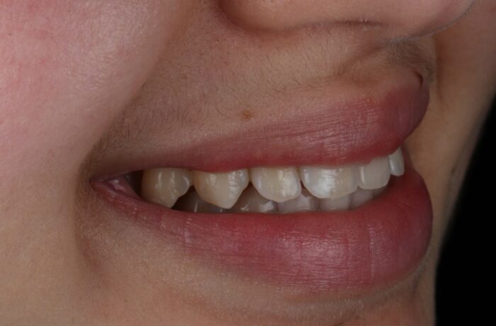 After - Cheadle Hulme Dental