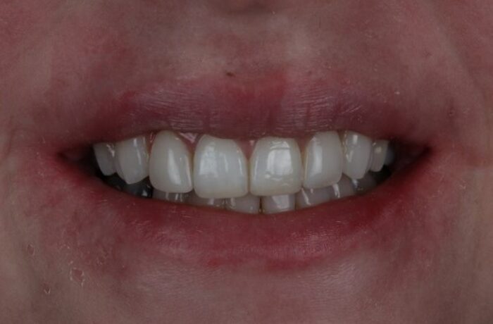 After - Cheadle Hulme Dental