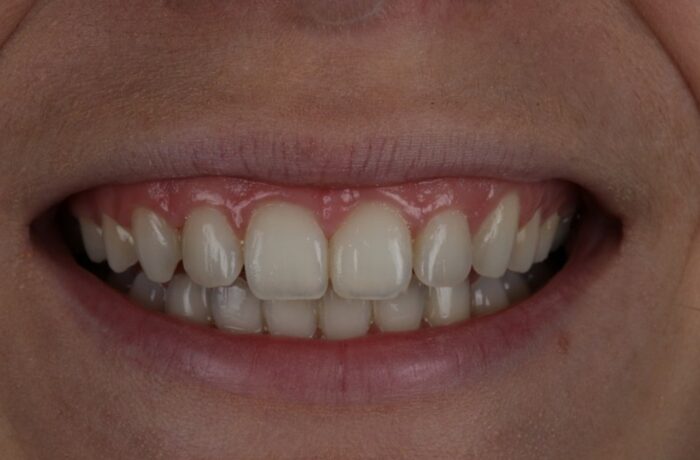 After - Cheadle Hulme Dental