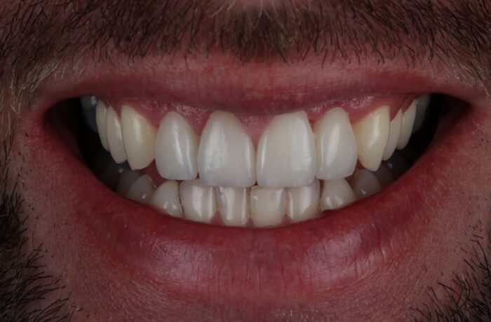 After - Cheadle Hulme Dental