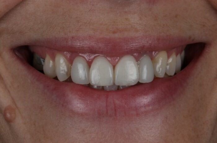 After - Cheadle Hulme Dental
