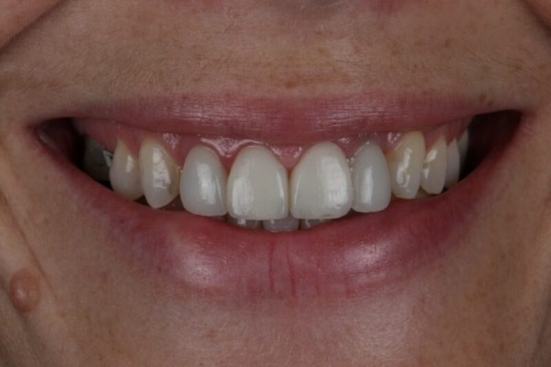 After - Cheadle Hulme Dental