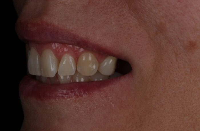 Before - Cheadle Hulme Dental