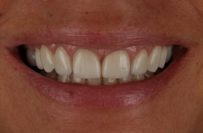 After - Cheadle Hulme Dental