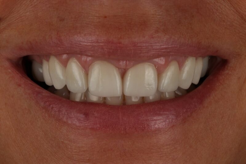 After - Cheadle Hulme Dental