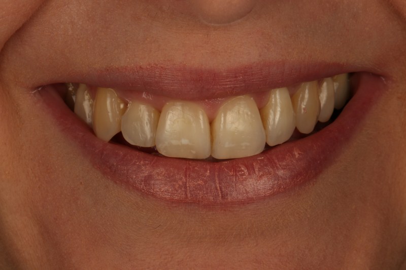 After - Cheadle Hulme Dental