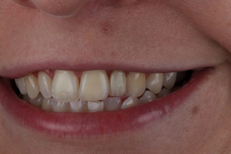 After - Cheadle Hulme Dental