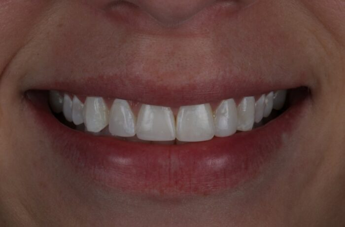 After - Cheadle Hulme Dental