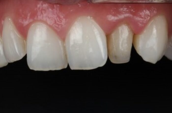 Before - Cheadle Hulme Dental