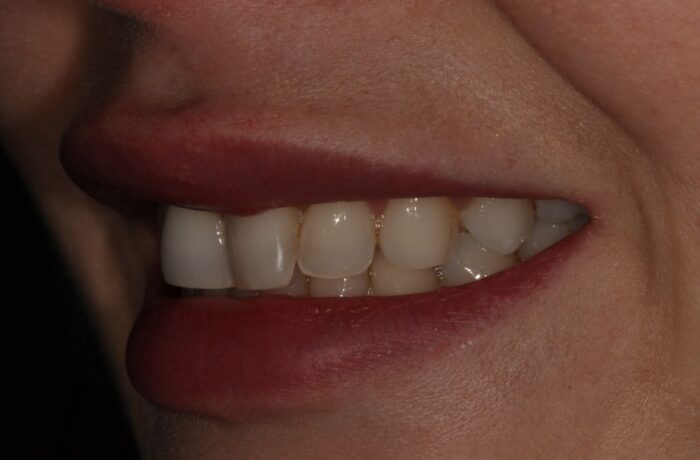 Before - Cheadle Hulme Dental