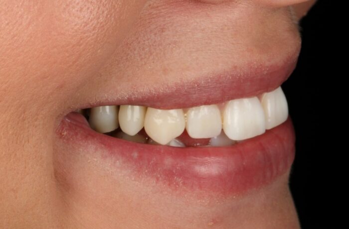 After - Cheadle Hulme Dental