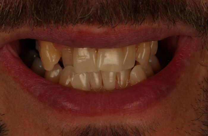 Before - Cheadle Hulme Dental