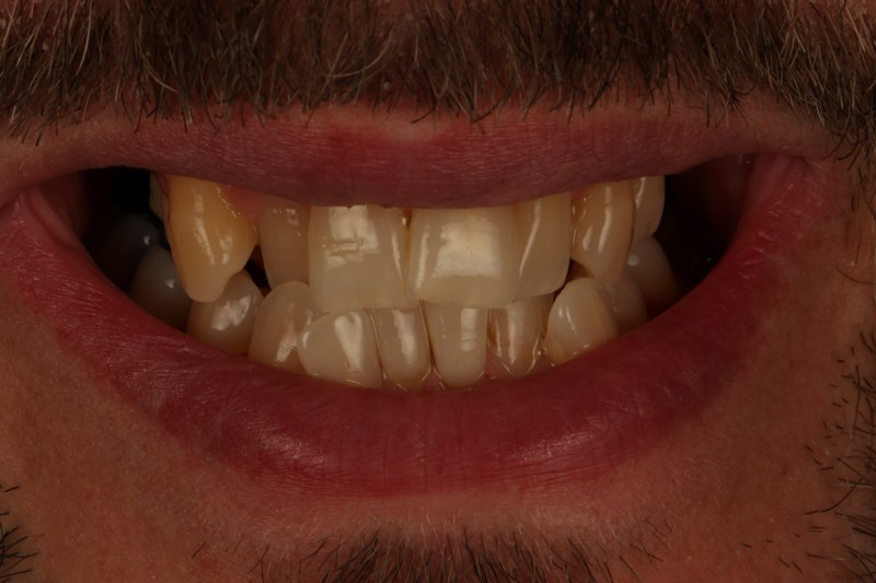 Before - Cheadle Hulme Dental