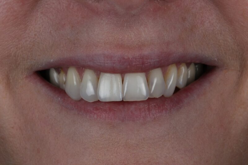 After - Cheadle Hulme Dental