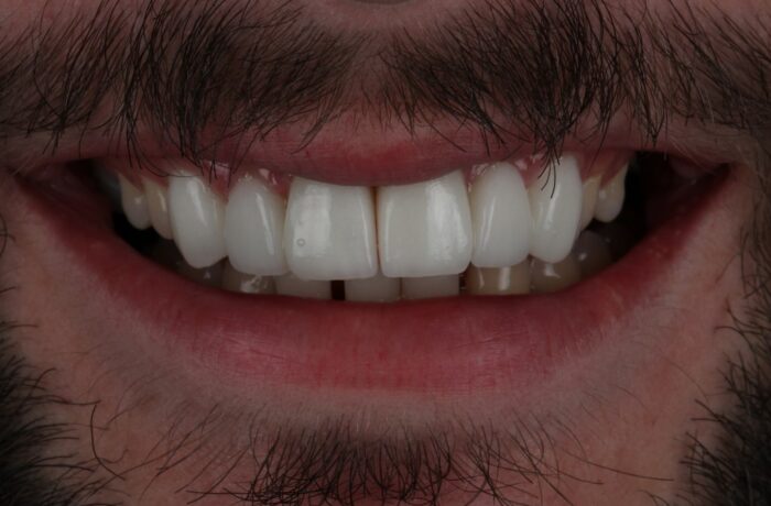 After - Cheadle Hulme Dental