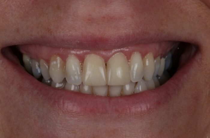 After - Cheadle Hulme Dental