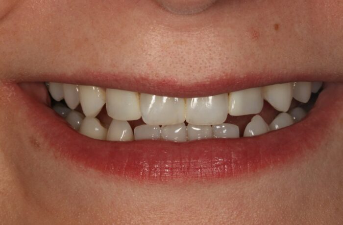 After - Cheadle Hulme Dental