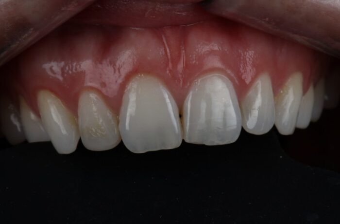 Before - Cheadle Hulme Dental