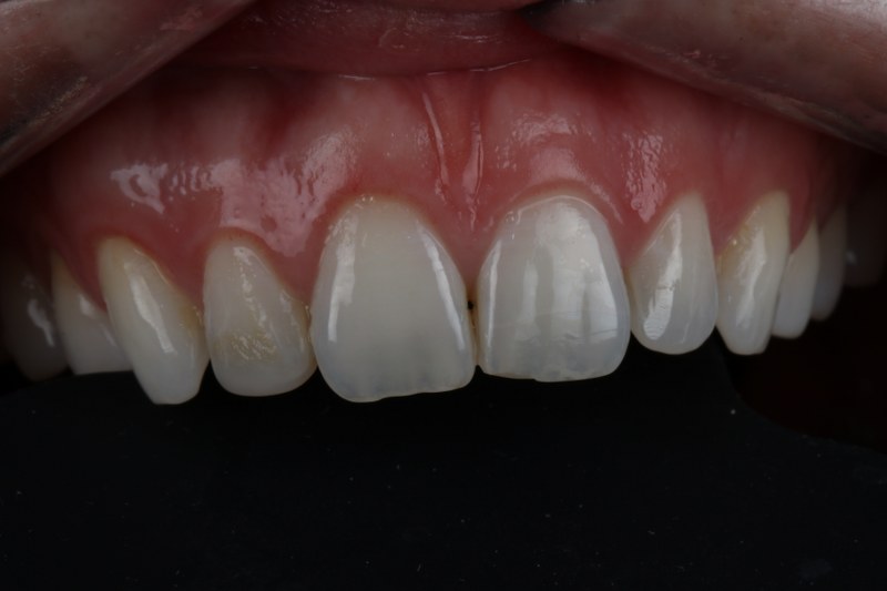 Before - Cheadle Hulme Dental