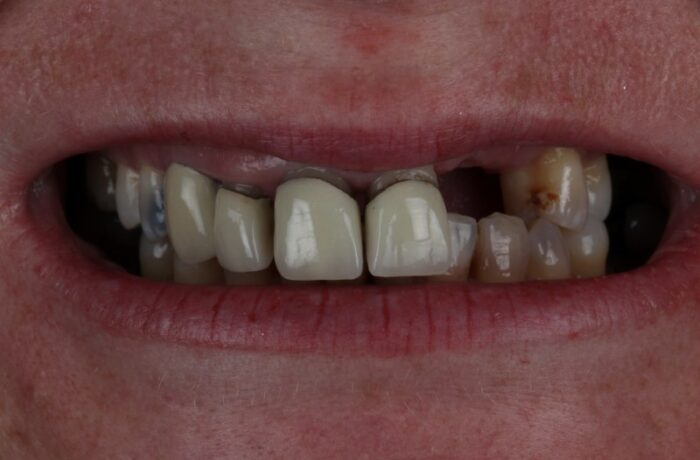 Before - Cheadle Hulme Dental