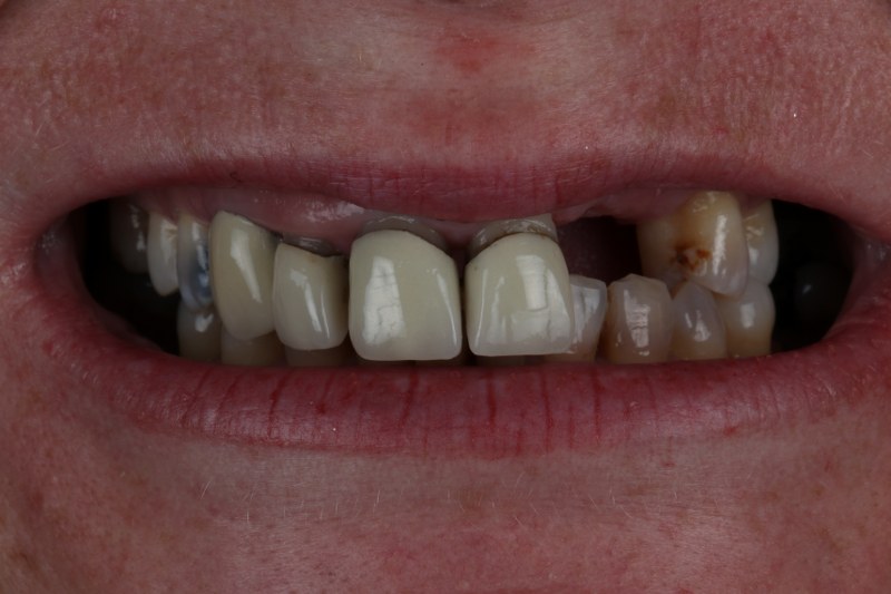 Before - Cheadle Hulme Dental
