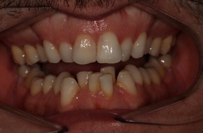 Before - Cheadle Hulme Dental