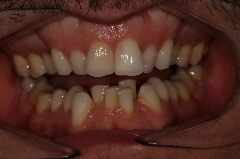 Before - Cheadle Hulme Dental