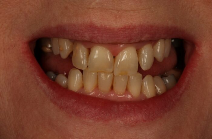 Before - Cheadle Hulme Dental