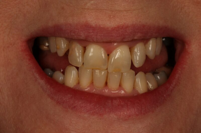 Before - Cheadle Hulme Dental