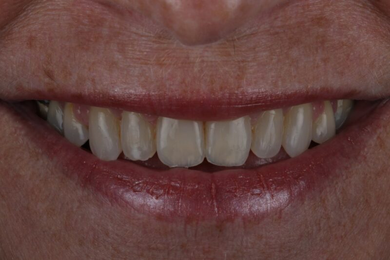 After - Cheadle Hulme Dental