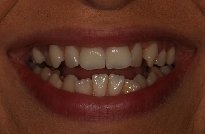 Before - Cheadle Hulme Dental