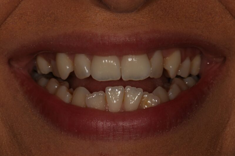 Before - Cheadle Hulme Dental