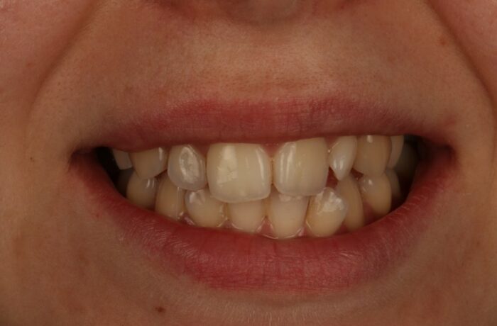 Before - Cheadle Hulme Dental