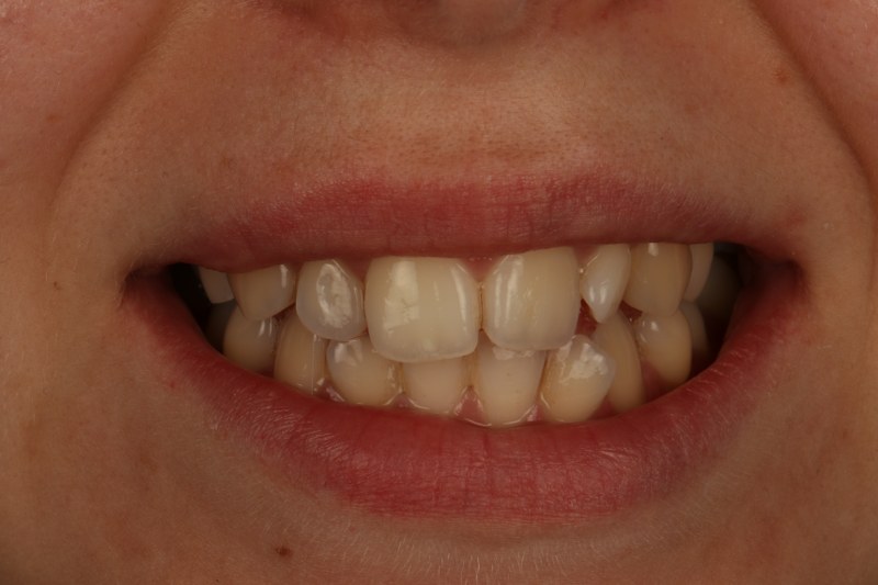 Before - Cheadle Hulme Dental