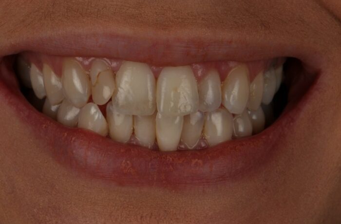 Before - Cheadle Hulme Dental