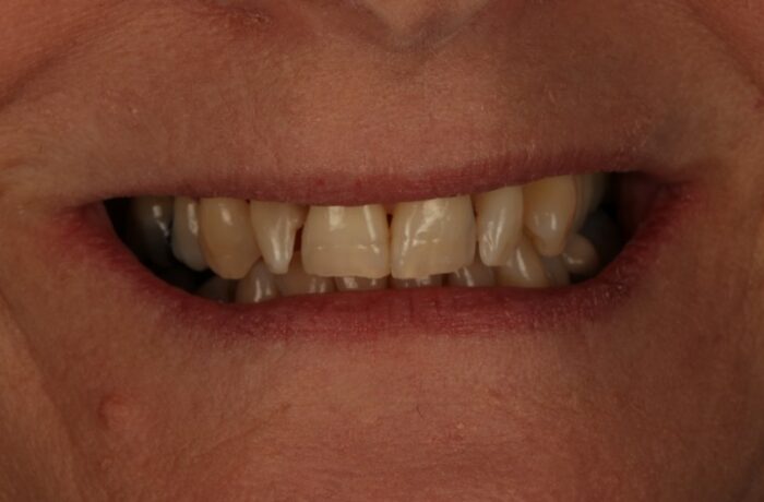 Before - Cheadle Hulme Dental