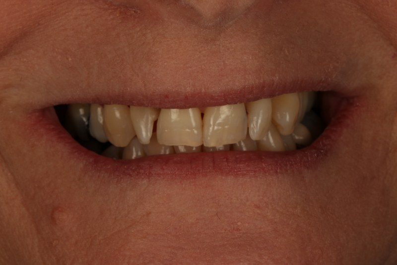 Before - Cheadle Hulme Dental