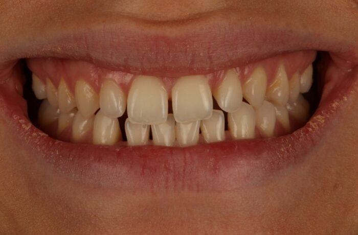 Before - Cheadle Hulme Dental