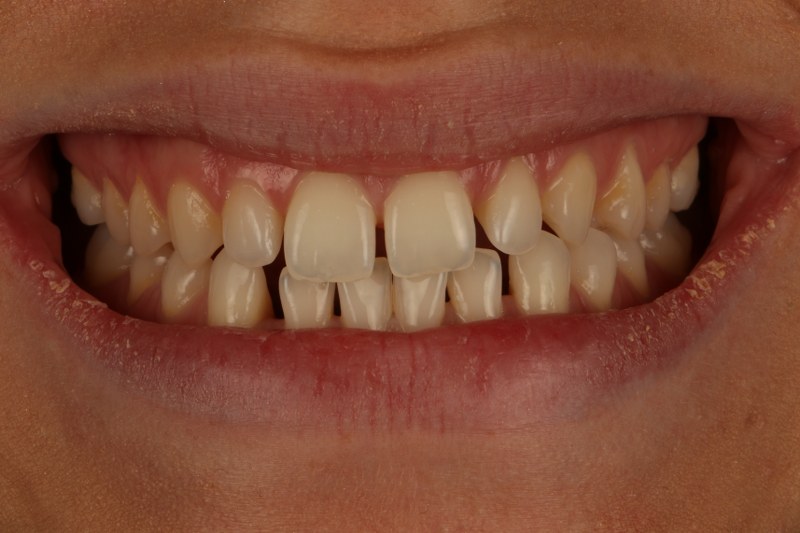 Before - Cheadle Hulme Dental