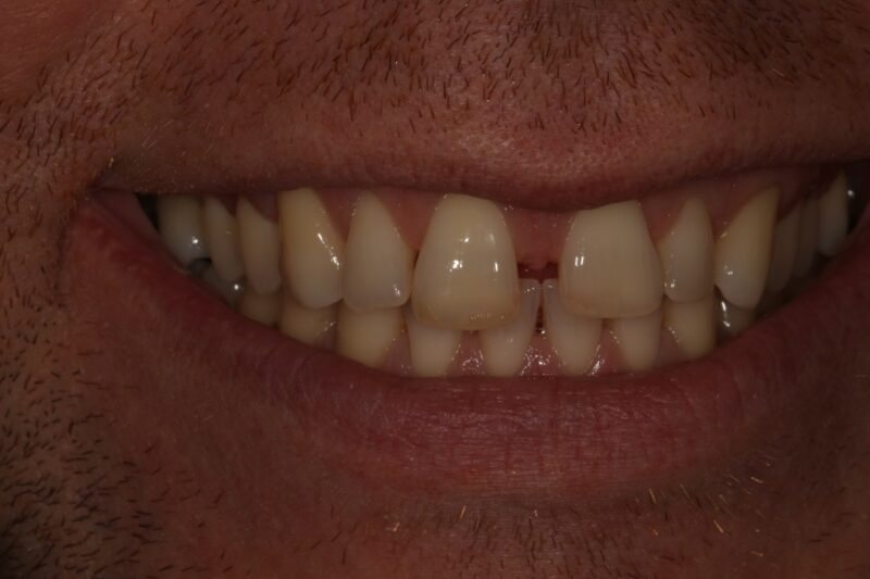 Before - Cheadle Hulme Dental