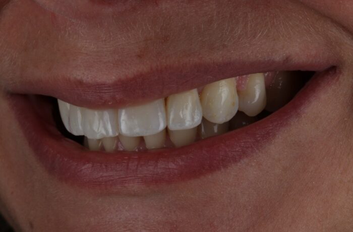 After - Cheadle Hulme Dental
